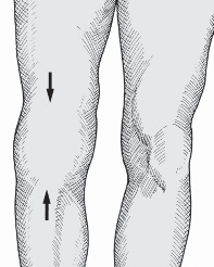 Unlock Joint Health: Essential range of movements assessment