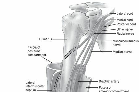 Humeral Shaft Fractures: Expert Insights on Diagnosis & Treatment