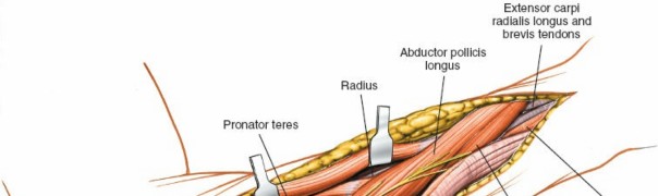 Illustration 66 for Mastering Approaches to the Upper Third of the Radius