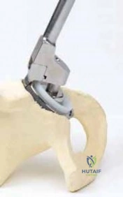 Clinical Image