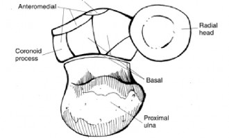 Illustration 19 for Master Diagnosis: Shoulder & Elbow Cases (Reproduced with Permission)