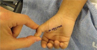 Illustration 3 for Orthopedic Hand Cases: A Patient's Journey, Is a Year Old a Factor?