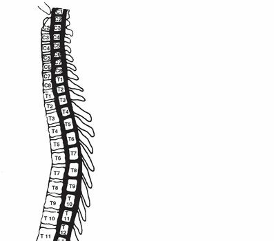 Illustration of thoracolumbar spine injuries - Dr. Mohammed Hutaif