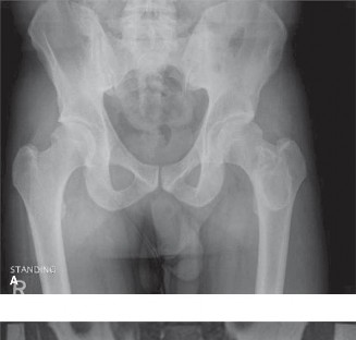Illustration of oncology cases fibrous - Dr. Mohammed Hutaif