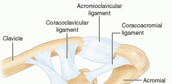 Open Fixation for Scapular Fractures: What You Need to Know