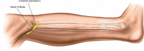 Achieve Full Fibula Access: The Distal to Proximal Approach