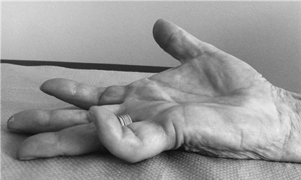 Illustration 2 for Master Hands and Paediatric Orthopaedics: Diagnose & Treat