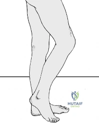 Limb Nerves: Know Where to Look & What to Ask the Patient