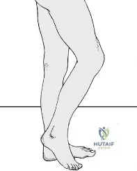 Limb Nerves: Know Where to Look & What to Ask the Patient