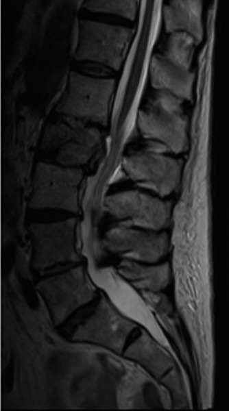 Spine Cases: Consider the Patient for Accurate Diagnosis