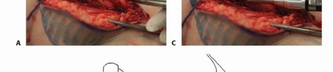 صورة تظهر جراحين في غرفة عمليات حديثة