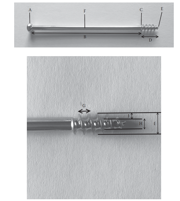 Why Screw Diameter in mm Matters for Strength & Fit