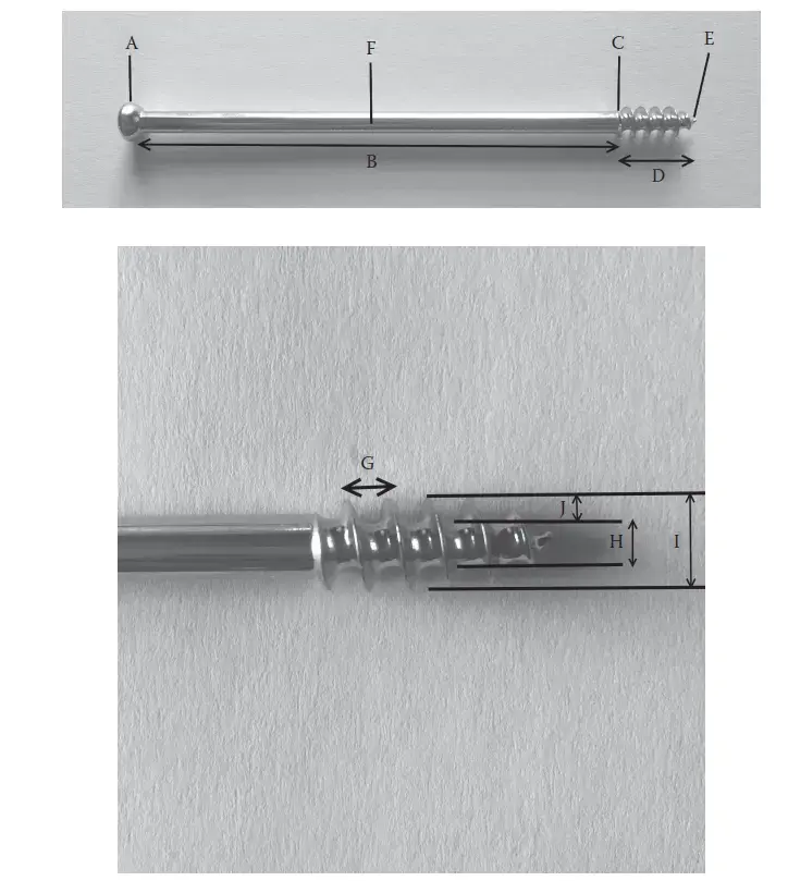 صورة توضيحية لـ شفاء الكسور ببراغي العظام: دليل شامل للمرضى من الأستاذ الدكتور محمد هطيف