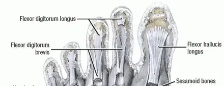 صورة توضيحية لـ إصبع لاعب العشب: دليلك الشامل للتعافي وعودة الحياة الطبيعية مع الأستاذ الدكتور محمد هطيف