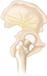 Mastering Direct Lateral Exposure for Revision Total Hip Success