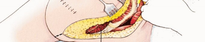 وصف طبي دقيق للمريض