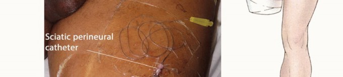 وصف طبي دقيق للمريض