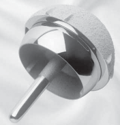 Hip Resurfacing: Preserving Vital Bone Around the Femoral Neck