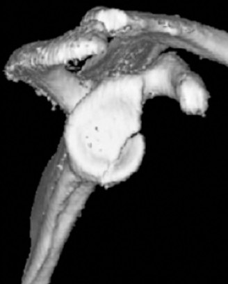 Illustration 34 for Acad Orthop Surg Challenge: Diagnose Shoulder Pain Case 1