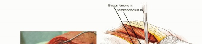وصف طبي دقيق للمريض