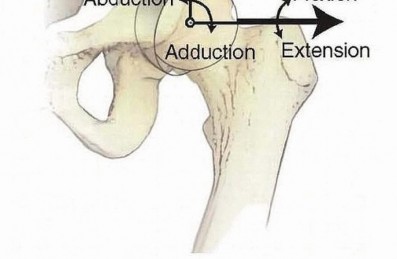 Illustration 2 for Restore Hip Health: Pelvic Osteotomy for Acetabular Dysplasia & CEA of Less