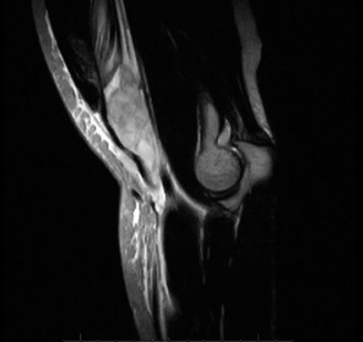 Illustration 14 for Solve Orthopedic Cases: Extensor Carpi Radialis Brevis & Elbow Pain