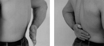 Illustration 3 for Acad Orthop Surg Challenge: Diagnose Shoulder Pain Case 1