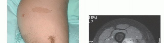 وصف طبي دقيق للمريض