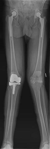 Illustration 11 for Ace FRCS Orthopaedics: Oxford University Press Adult Pathology Viva