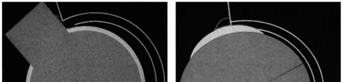 صورة توضيحية لـ منظار مفصل الورك لعلاج الانحشار الفخذي الحقي: دليل شامل من الأستاذ الدكتور محمد هطيف في صنعاء