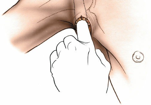 Illustration 11 for Essential Guide: Mastering Every Approach to the Shoulder