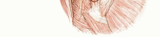 صورة توضيحية لـ استئصال أورام الكتف مع الحفاظ على الطرف: أحدث التقنيات لنتائج مثالية مع الأستاذ الدكتور محمد هطيف