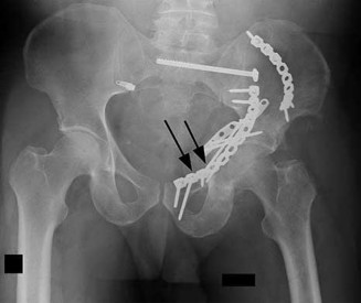 Orthopedic Surgery Mock Exam - Set B3CDB8