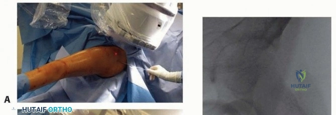 Professor Dr Mohammad Hutaif  The Best Orthopedic Surgeon in Sanaa Yemen