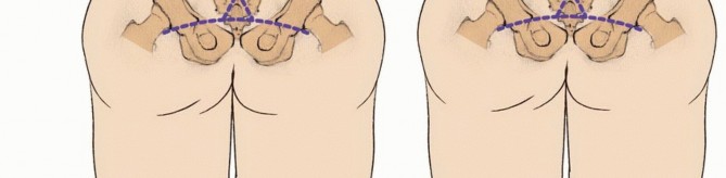 وصف طبي دقيق للمريض