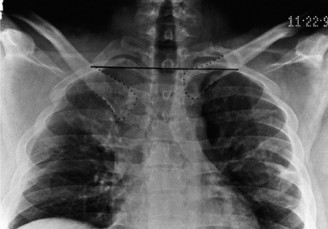 Illustration 19 for Solve Shoulder & Elbow Cases: When a Patient Presents to Clinic