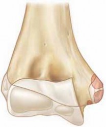 Illustration of full range of motion - Dr. Mohammed Hutaif