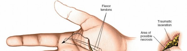 Illustration 145 for Essential Surgical Approaches: Uncover Every Aspect of the Wrist