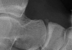 Orthopedic Surgery Mock Exam - Set 01830B