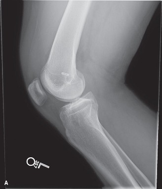 Female Athlete Triad: Diagnosing Critical Sports Medicine Cases