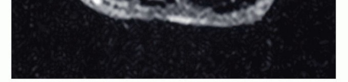 صورة توضيحية لفريق طبي يناقش حالة مريض