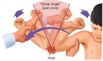 Illustration 99 for Right Shoulder Pain? Avoid This Common X-ray Mistake.
