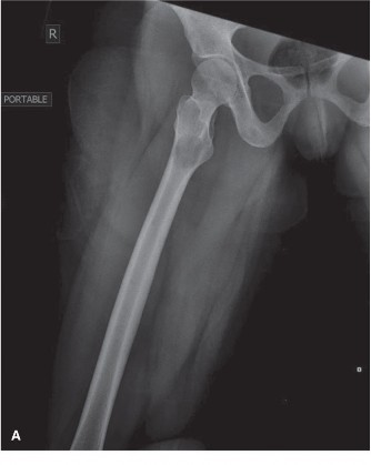 Illustration of oncology cases multiple - Dr. Mohammed Hutaif