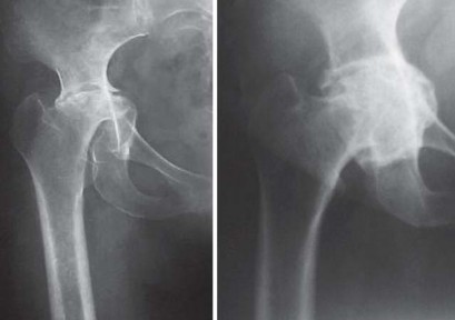 وصف طبي دقيق للمريض