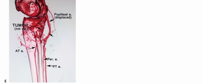 صورة توضيحية لجهاز الرنين المغناطيسي (MRI)