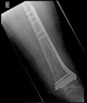 Illustration 2 for Tackle a Complex Lower Limb Trauma Examination Question