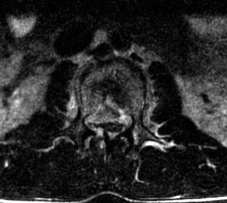 Illustration 45 for Master Orthopedic Spine Cases: Sharpen Your Diagnostic Skills