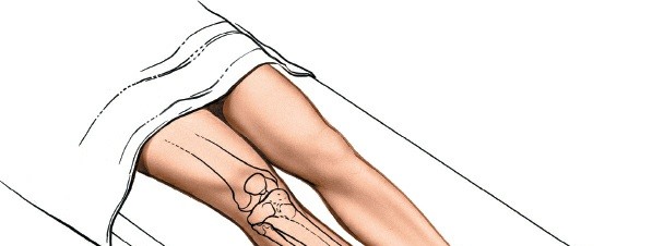 Master the Tibia Anterior Approach: Safe Surgical Techniques