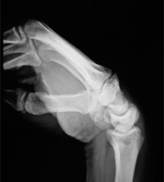 Illustration 2 for Wrist Recovery Guide: Mastering Degrees with Forearm Movement