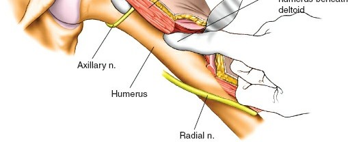 Illustration 119 for Essential Guide: Mastering Every Approach to the Shoulder